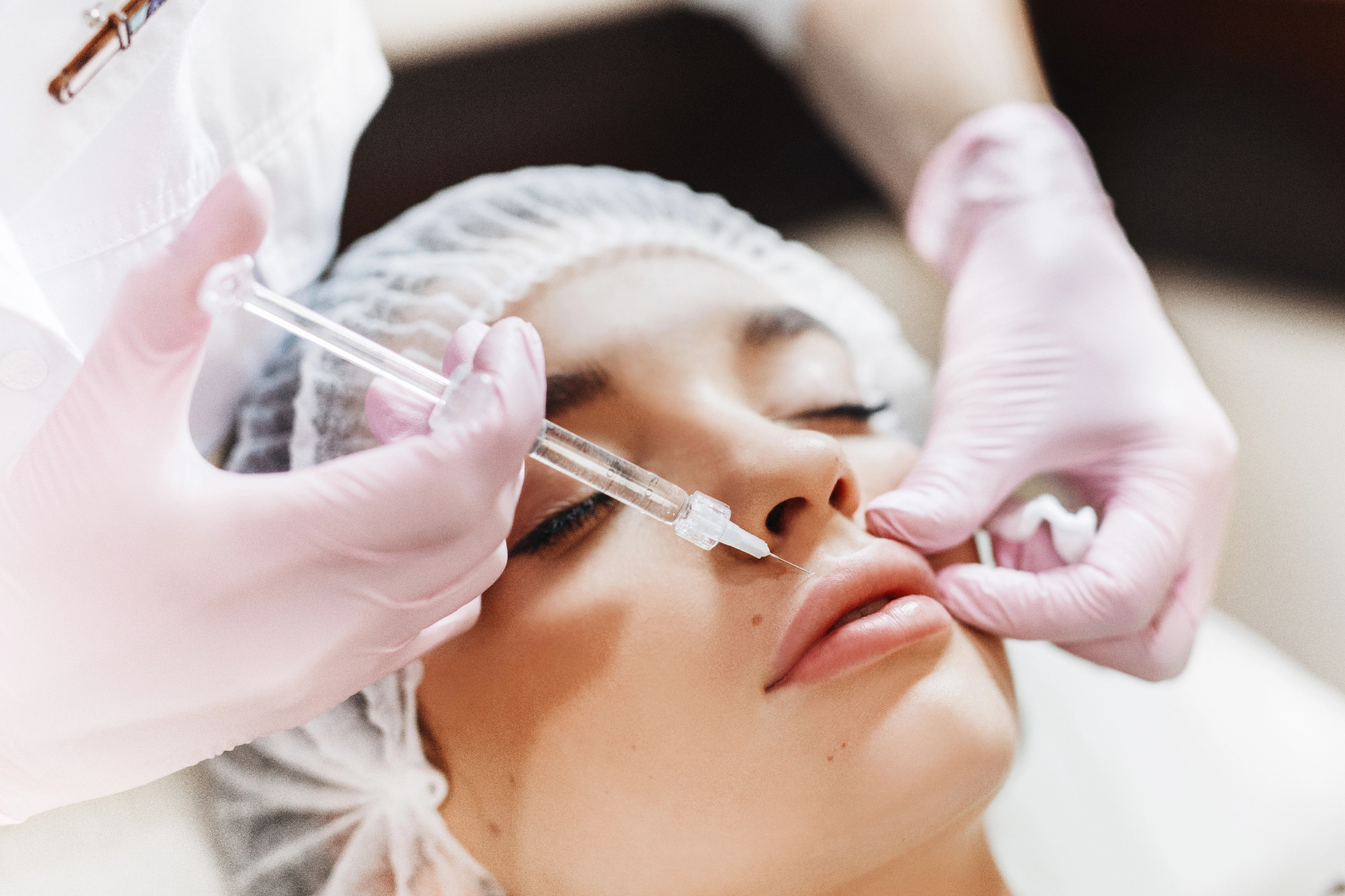 Moje iskustvo s botox tretmanima nakon estetske kirurgije